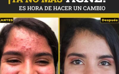 Genera un excelente cambio en tu rostro con el Dr.Eric Rojas.