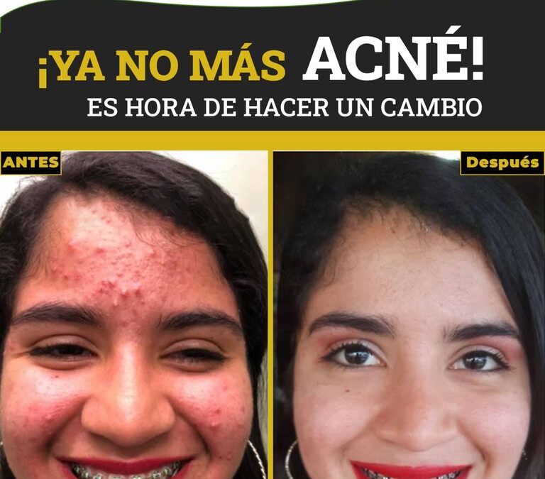 Genera un excelente cambio en tu rostro con el Dr.Eric Rojas.