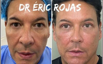 REFRESCAMIENTO FACIAL