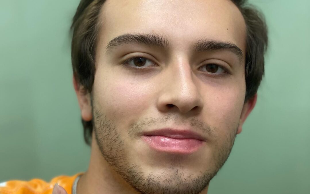 ROSTROS PERFECTOS libres de ACNÉ