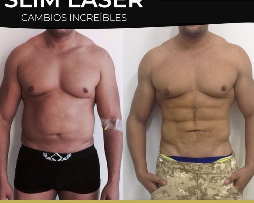 Nuestra calidad de procedimiento Slim Láser habla por si sola.