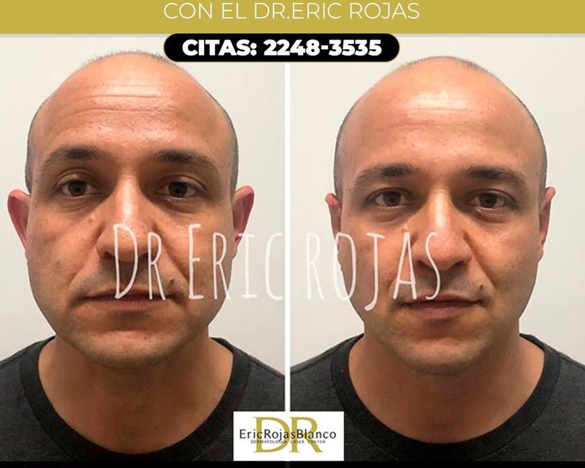 Corrije tus orejas y luce de la mejor manera.