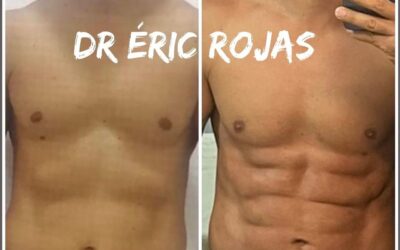 SLIM LÁSER DR ÉRIC ROJAS 22483535