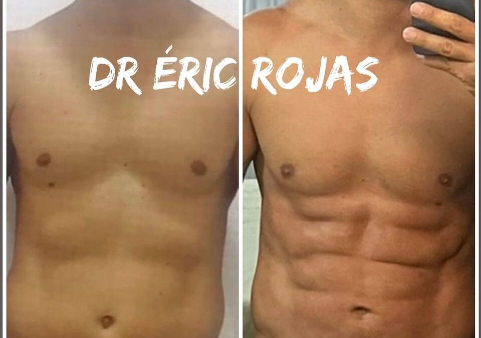 SLIM LÁSER DR ÉRIC ROJAS 22483535