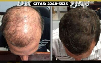 No te quedes sin pelo.