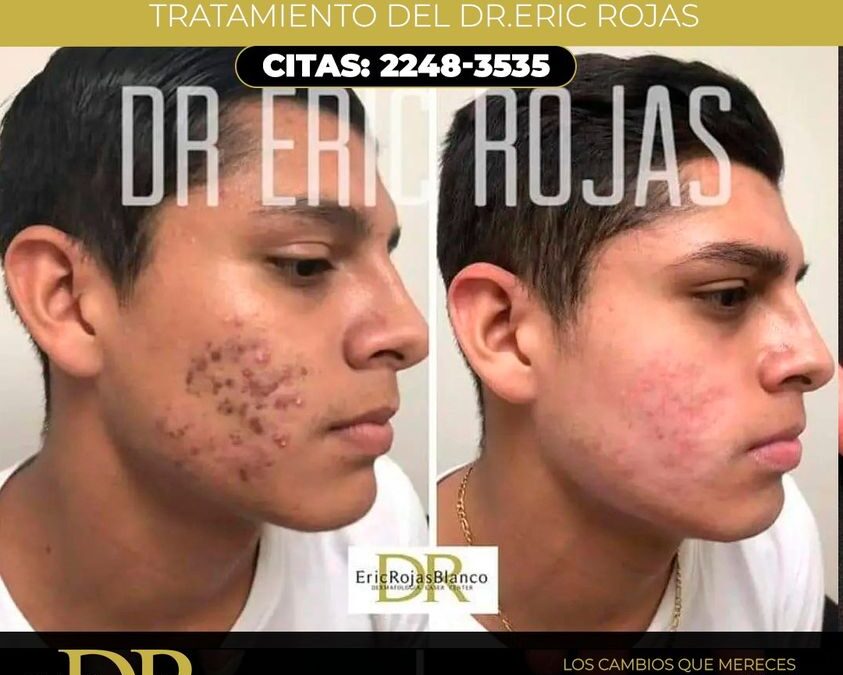 Estos son las mejorias que mereces tener.