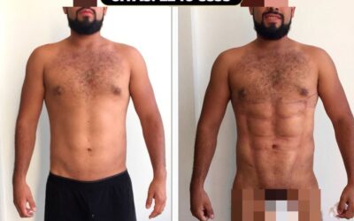 SLIM LÁSER, Dr. Eric Rojas Blanco.