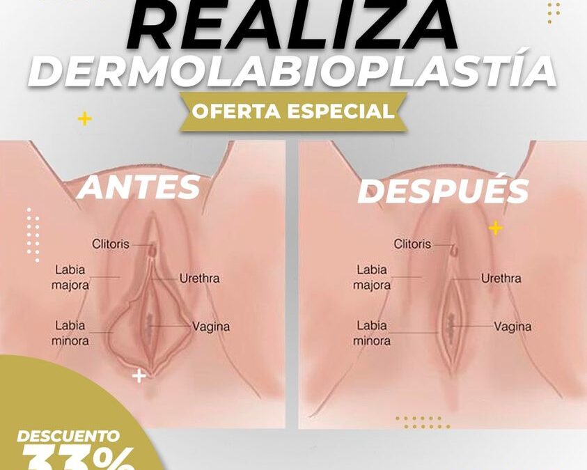 APROVECHA ESTA OFERTA.