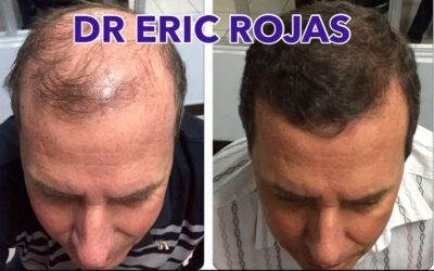 Nosotros te devolvemos tu cabello.