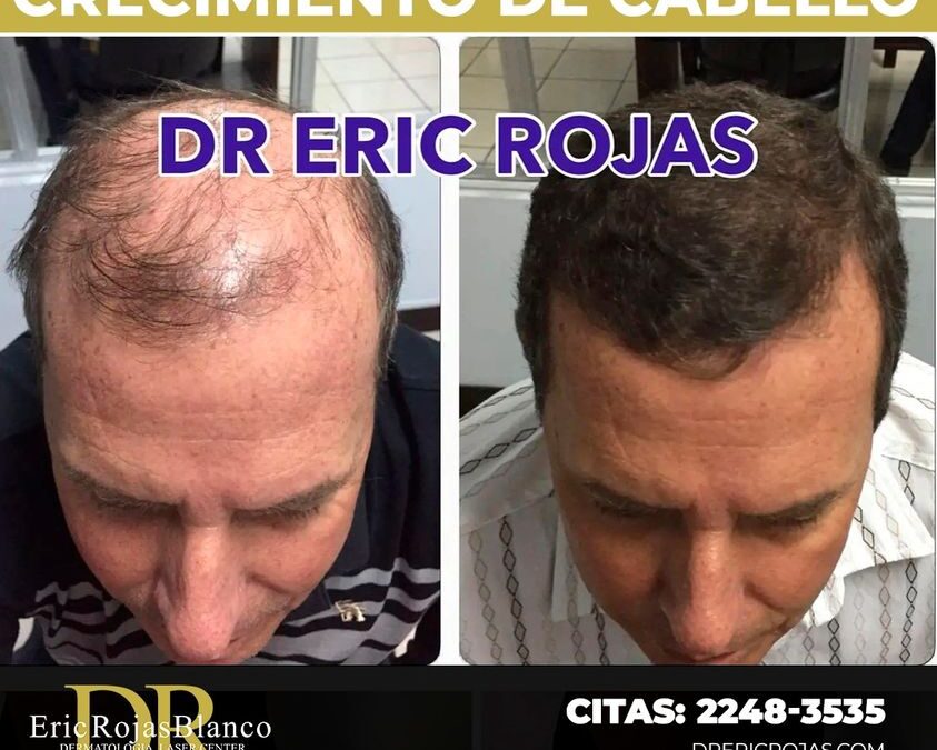 Nosotros te devolvemos tu cabello.