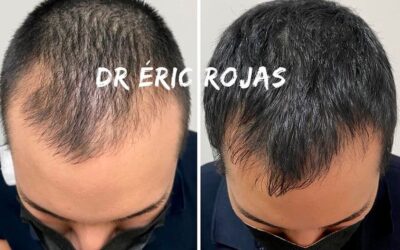 No perdás tu cabello.
