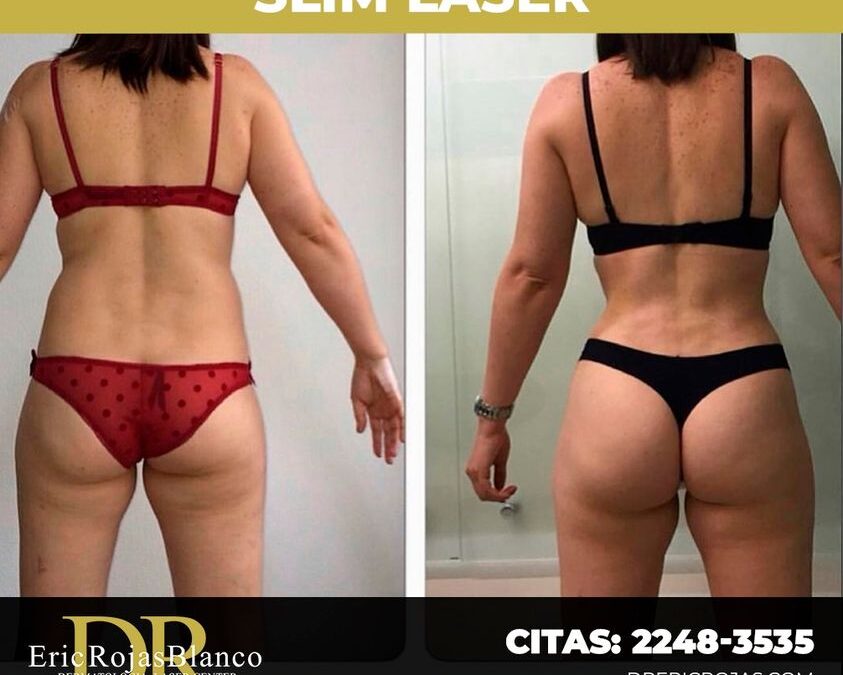 Slim Láser, contamos con el mejor equpo.