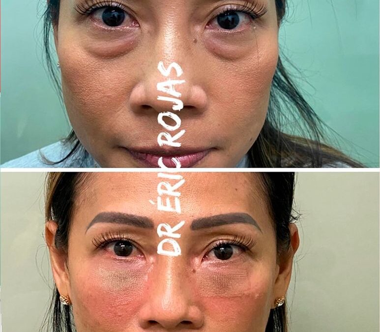 Obtén los cambios que deseas con nosotros.