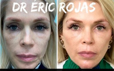 Luce mejor con el Dr. Eric Rojas Blanco.