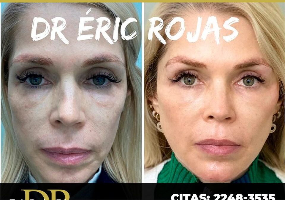 Luce mejor con el Dr. Eric Rojas Blanco.