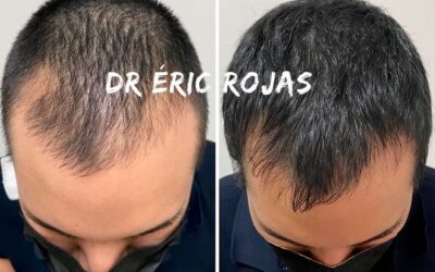 Hacemos que tu cabello vuelva