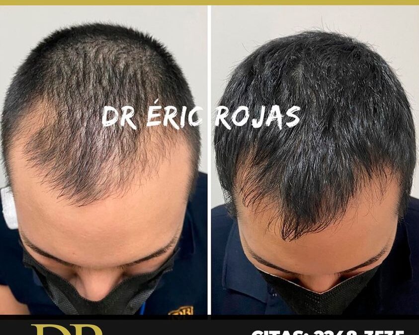 Hacemos que tu cabello vuelva