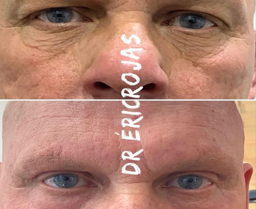 Rejuvenece con nosotros.