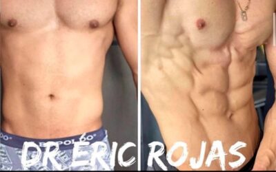 Marcaje de abdomen con el Dr. Eric Rojas.