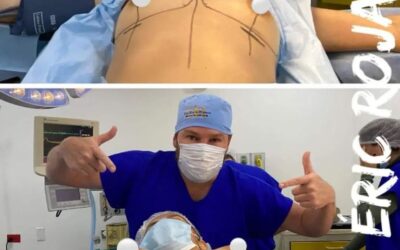 Aumento de mamas, Dr.Eric Rojas Blanco