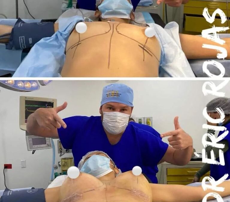 Aumento de mamas, Dr.Eric Rojas Blanco