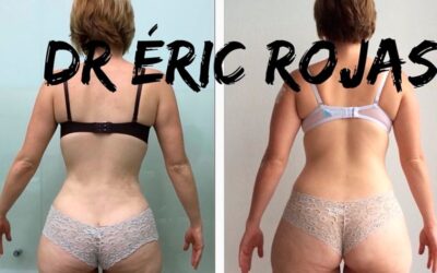 Slim láser, Dr.Eric Rojas Blanco