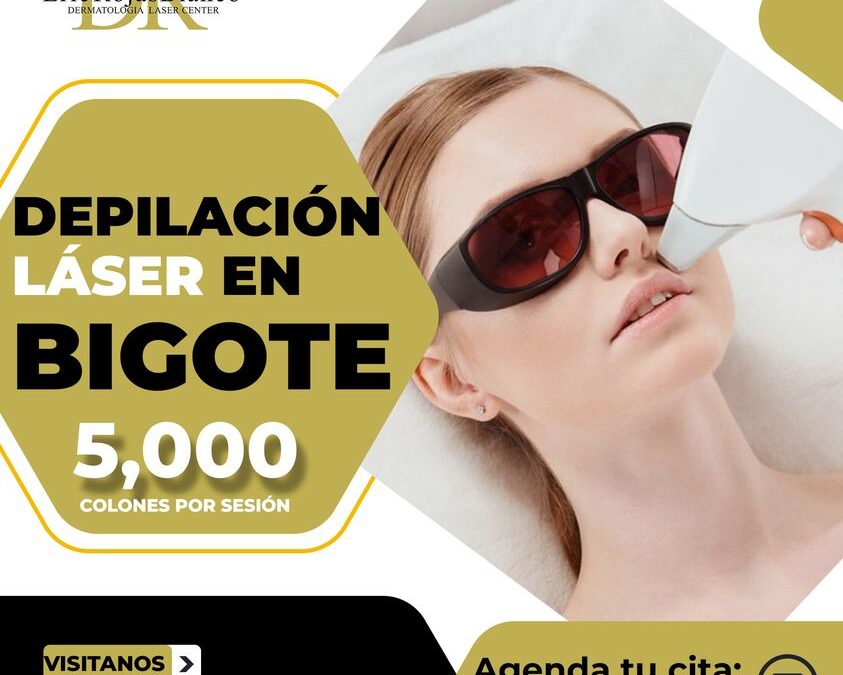 Depilación de bigote, 50% de descuento.