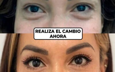 Rejuvenecimiento facial con el Dr.Eric Rojas.