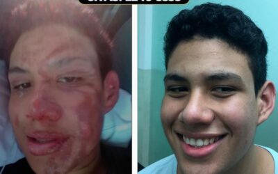 Tratamiento del Dr. Eric Rojas Blanco.