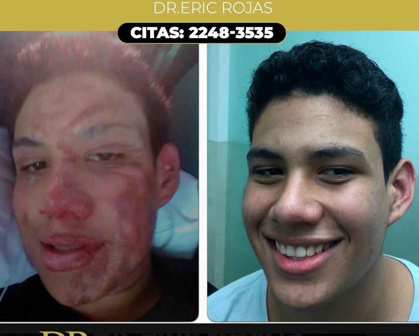 Tratamiento del Dr. Eric Rojas Blanco.