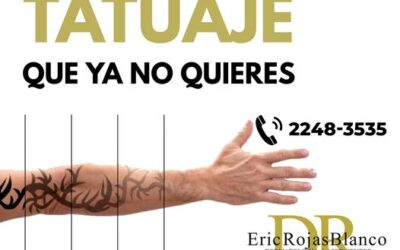 Remueve el tatuaje que no deseas.