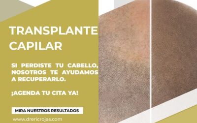 ¡RECUPERA TU CABELLO!