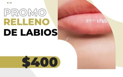 Promoción en relleno de Labios.