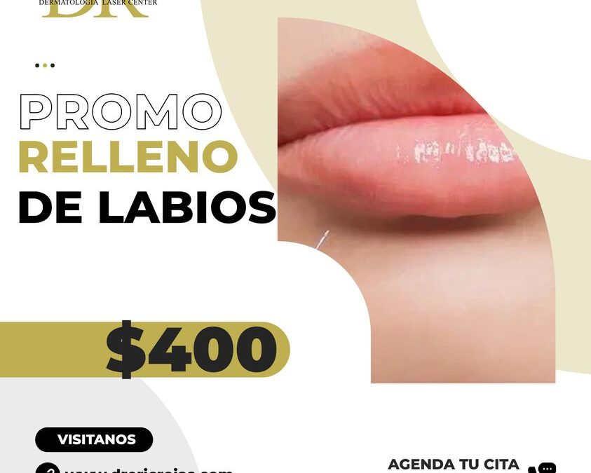 Promoción en relleno de Labios.
