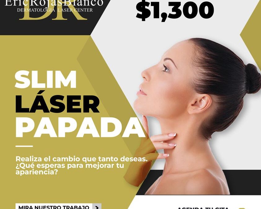 SÚPER PROMOCIÓN