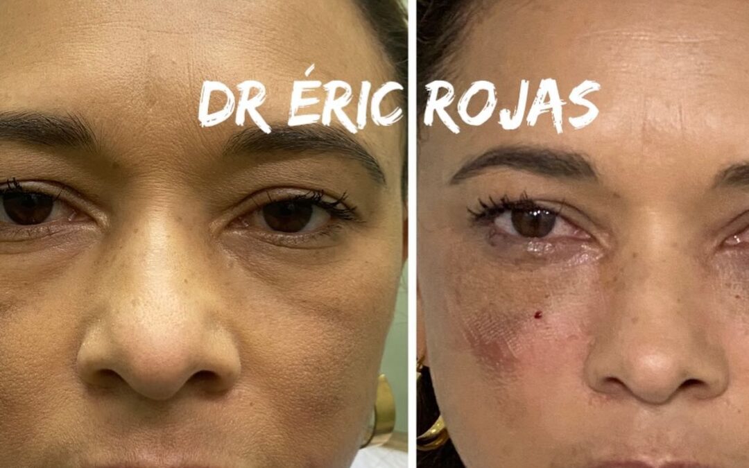 OJERAS YA NO MÁS DR ÉRIC ROJAS 22483535