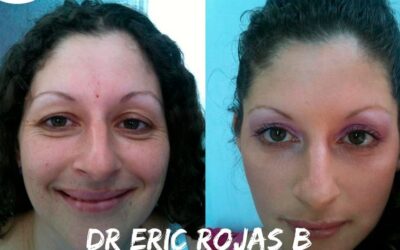 Rejuvenecimiento con el Dr. Eric Rojas.