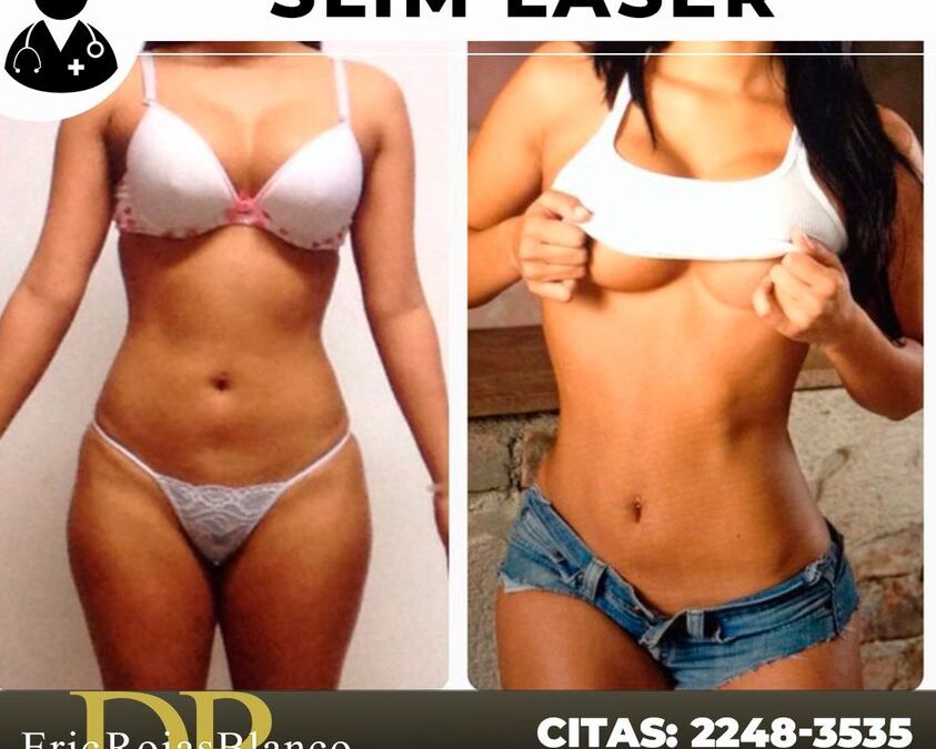 Slim láser, Dr. Eric Rojas.