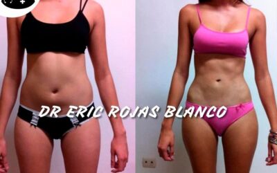 Slim Láser, Dr. Eric Rojas.