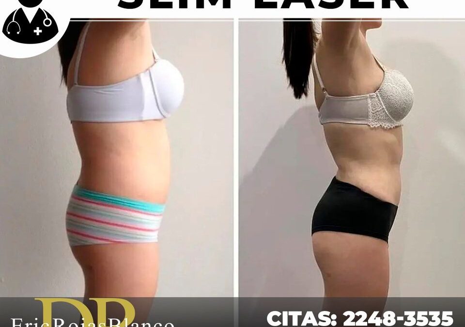 Los resultados de nuestros procedimiento siempre son los mejores.