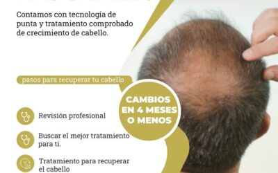 Implante capilar, nota los cambios en 4 meses o menos.