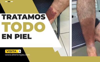 Cualquier problema de piel nosotros lo tratamos.