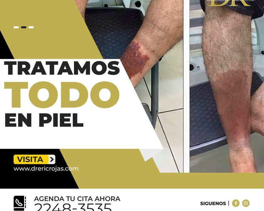 Cualquier problema de piel nosotros lo tratamos.