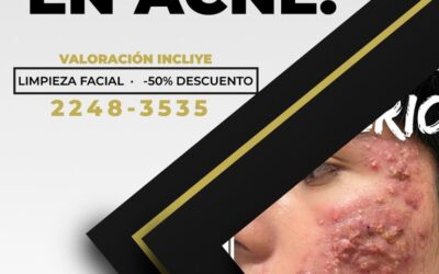 -Somos un centro especializado en el tratamiento del acné.