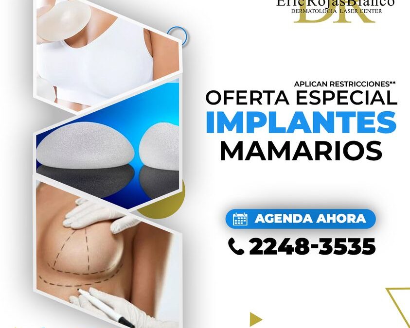 ¡Implantes por este mes! $2,700