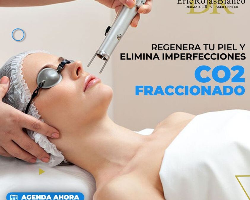 Co2 Fraccionado, activa el colágeno y la elastina de la piel.