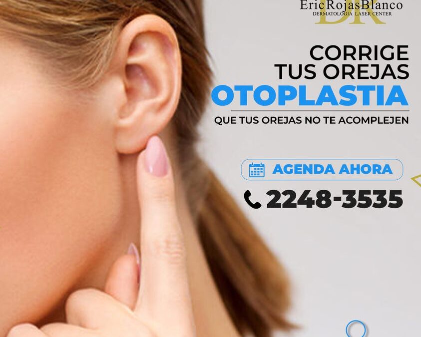 Corrección de orejas.🆒