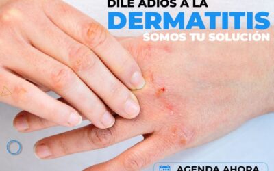 ¡Te brindamos una solución para la dermatitis! 🆒👇