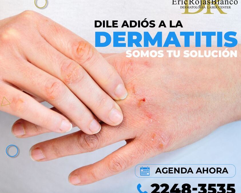 ¡Te brindamos una solución para la dermatitis! 🆒👇