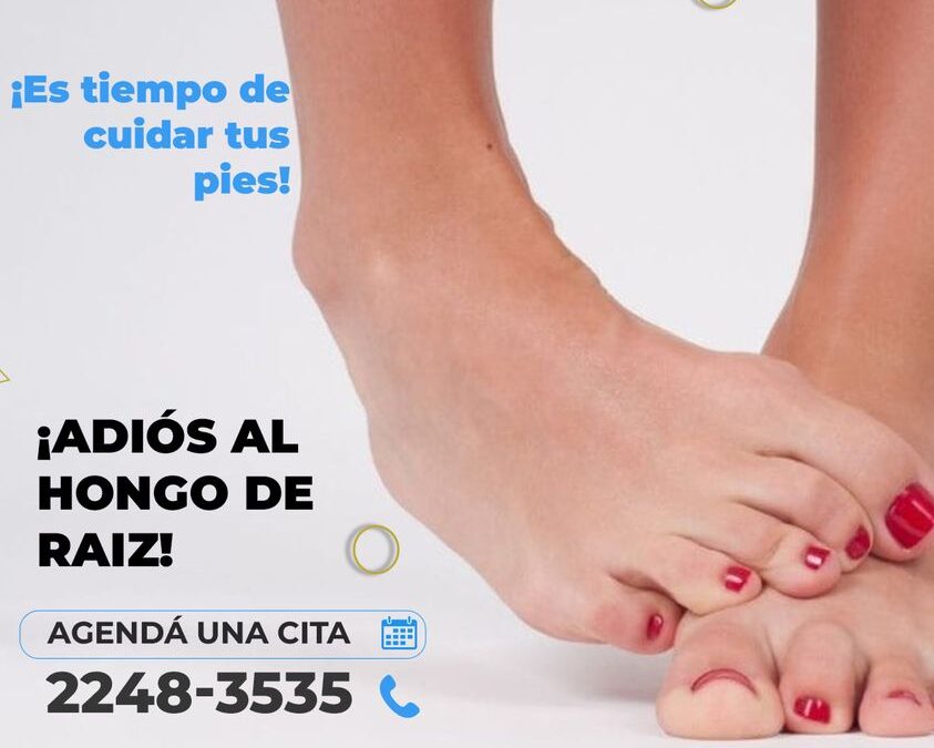 ¡Llegó el final para los hongos! Con nuestro exclusivo tratamiento XXX, no invasivo, es la mejor opción, eficaz y seguro.